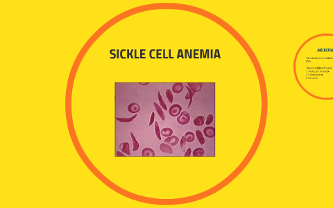 FALCIFORM ANEMIA by Daniel Fernando Andrade Fuentes