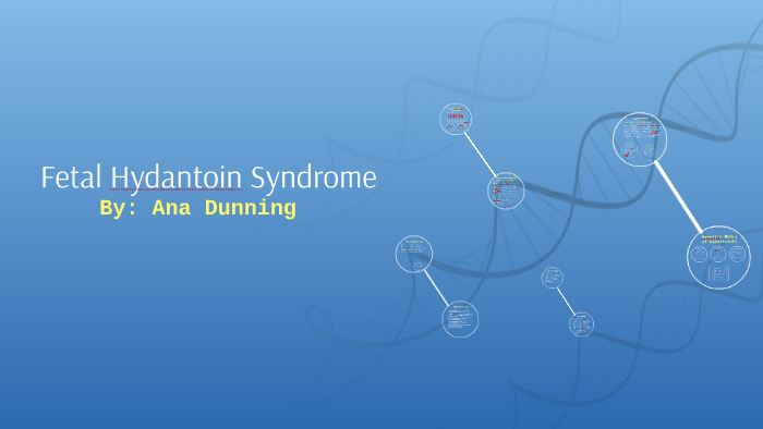 Fetal Hydantoin Syndrome By Ana Dunning On Prezi