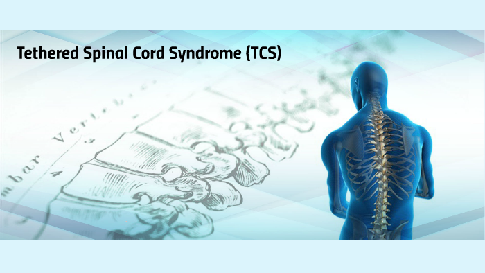 Tethered Spinal Cord Syndrome by Christina O.