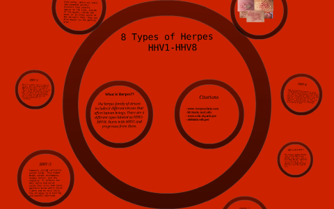 8 Types of Herpes by kaleb thompson on Prezi