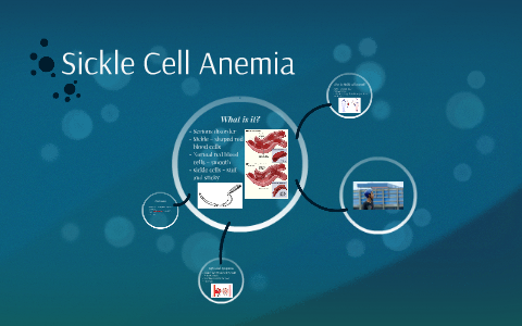 Sickle Cell Anemia by Gisela German on Prezi