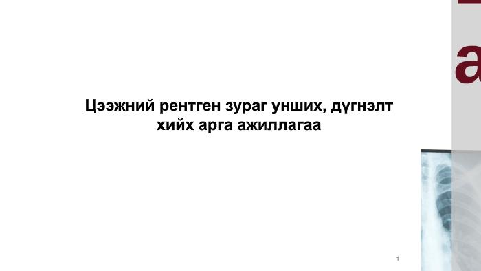Цээжний рентген зураг унших, дүгнэлт хийх арга ажиллагаа by munkhchimeg ...