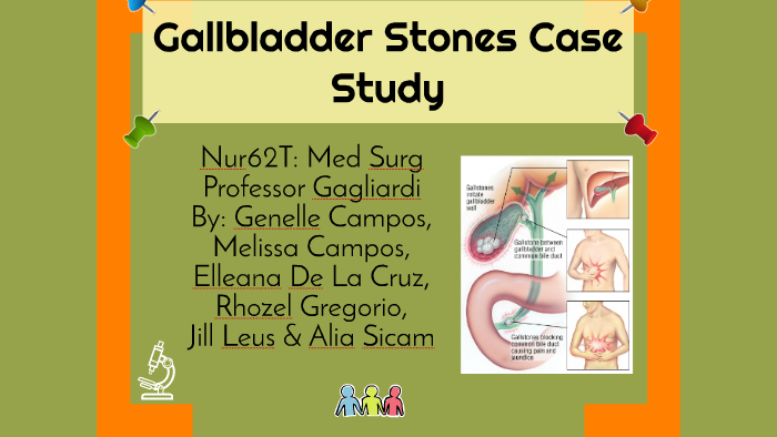 Cholelithiasis test picture