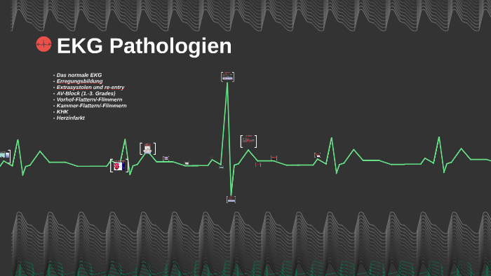 EKG PATHOLOGIEN RD visual data 4