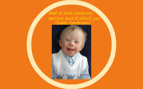 What Is Down Syndrome And How Does It Affect You? By Hugo Nunez On Prezi