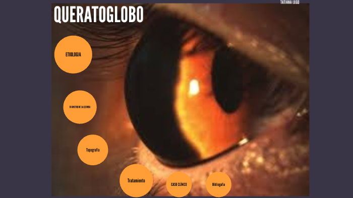 QUERATOGLOBO by tatiana lugo on Prezi