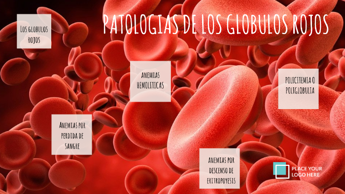 Trastornos De Los Globulos Rojos By Catalina Pimienta
