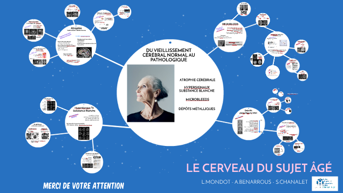 Cerveau Sujet âgé By Lydiane Mondot On Prezi - 