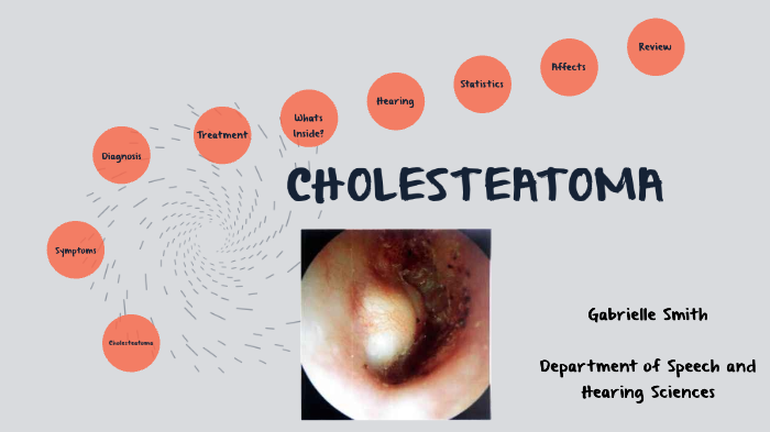 The Life of a Cholesteatoma by Gabrielle Smith on Prezi