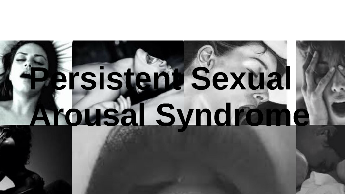 Persistent Sexual Arousal Syndrome By Francisca Perez 5188