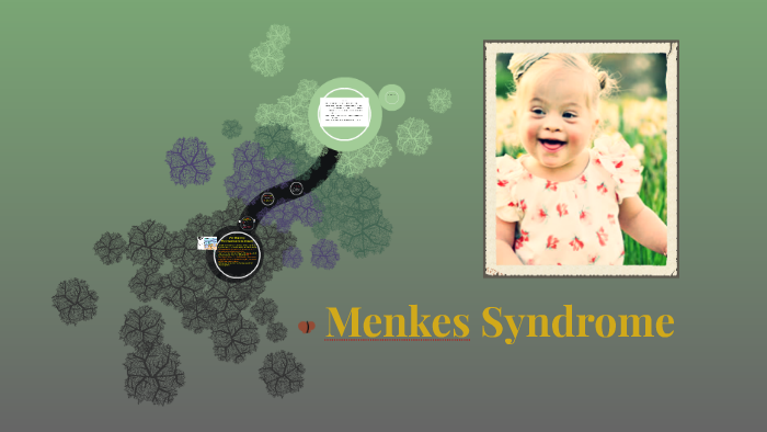 Menkes Syndrome By Anika 3 On Prezi 0025