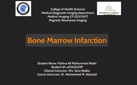 Bone Marrow Infarction by Fatima Alajmi on Prezi