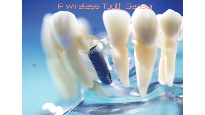 Sensor In Tooth A wireless Tooth Sensor by han yeo eun on Prezi