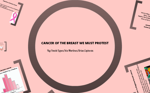 Breast Cancer by David Lopez on Prezi