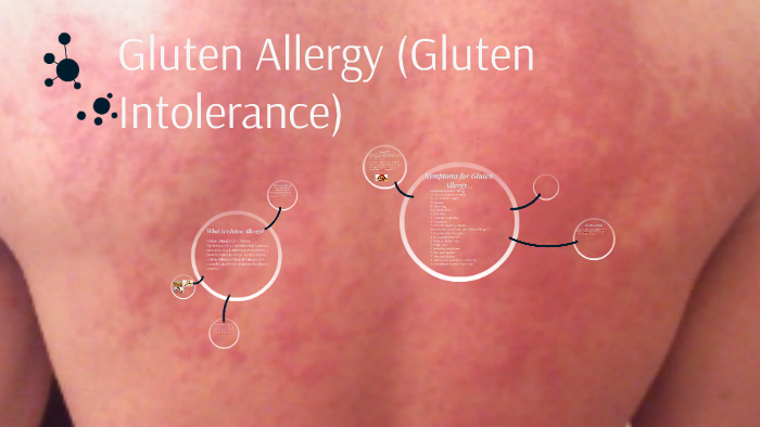 Como saber si soy alergica al gluten