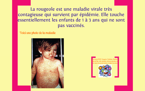 Les maladies de la petite enfance by sophie gingras on Prezi