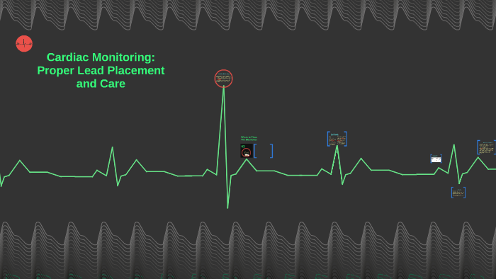 Cardiac Monitor 5 Lead Telemetry Placement