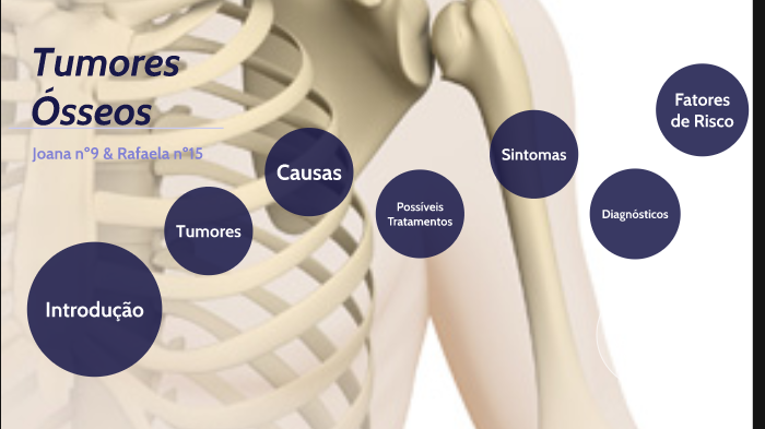 Tumor de ewing causas