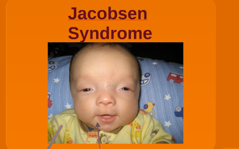 Jacobson syndrome by Mrs Miller on Prezi