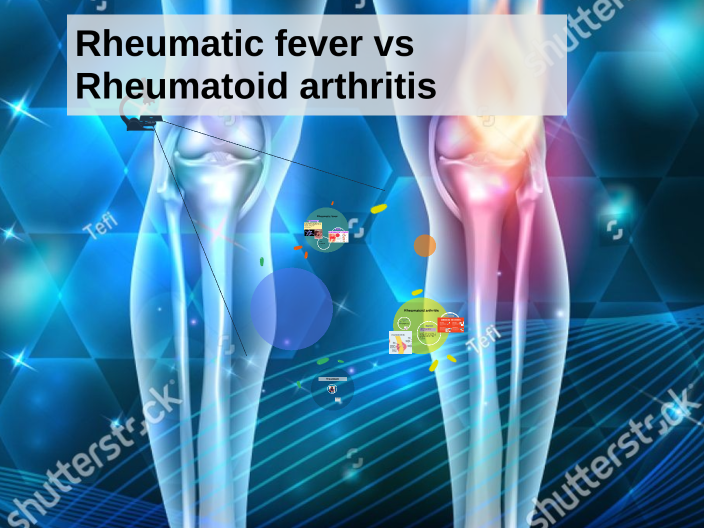 rheumatic fever vs rheumatoid arthritis by Abeer Ahmed on Prezi