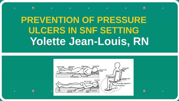 PREVENTION OF PRESSURE ULCERS IN SNF SETTING by on Prezi