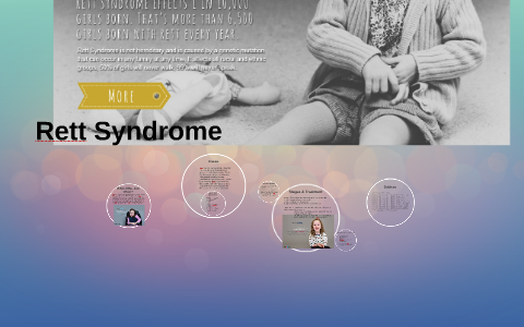 Rett Syndrome By C B