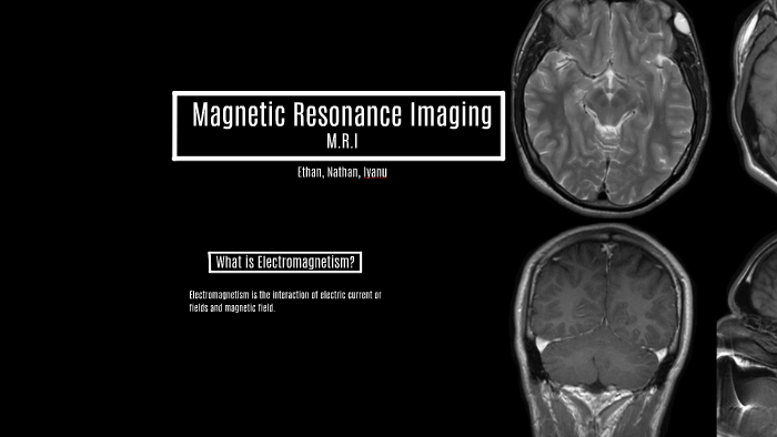Magnetic Resonance Imaging by Nathan R on Prezi