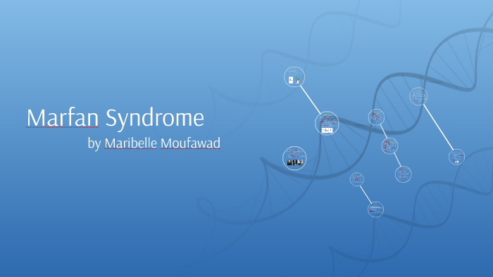 Marfan Syndrome by on Prezi