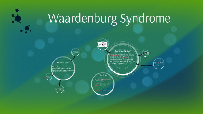 Waardenburg Syndrome By Nicholas Malone