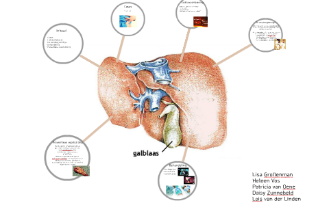 Klinische Les Galblaas Ontsteking by Patricia van Oene
