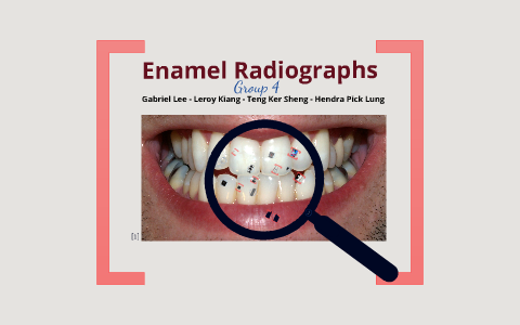 Enamel Radiography by Hendra Loy on Prezi