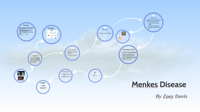 Menkes Disease By Zoey Davis On Prezi