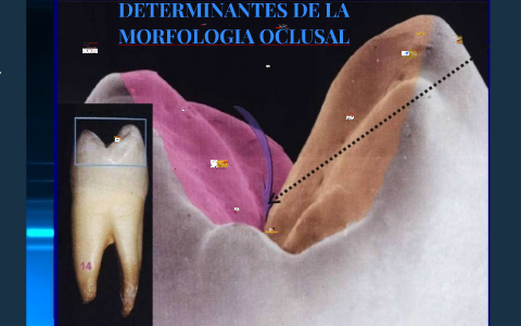 MORFOLOGÍA OCLUSAL DE DIENTES ANTERIORES by rosario castillo contreras ...