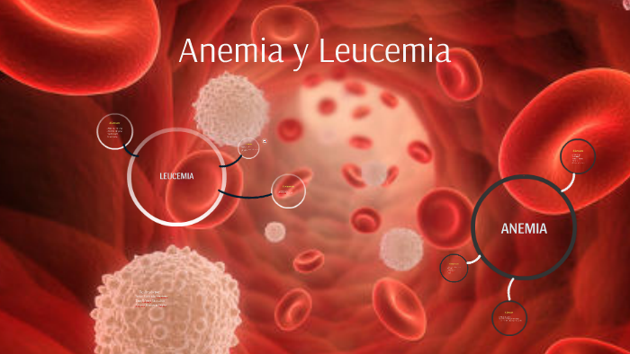 Anemia y Leucemia by Trabajo Viaje on Prezi