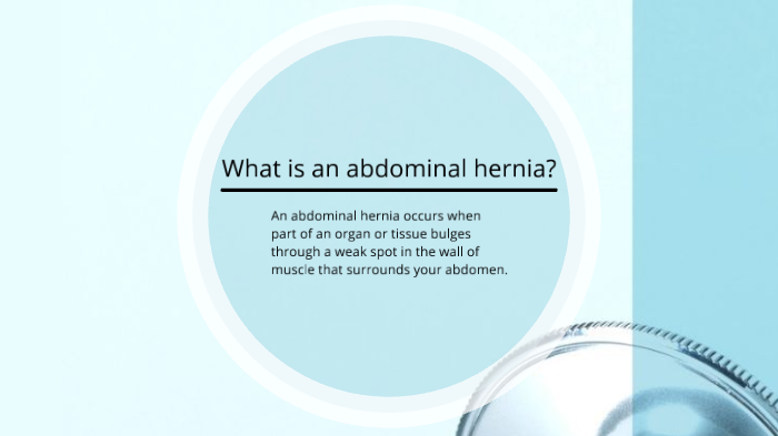 abdominal hernia by Tieraney Gathright on Prezi