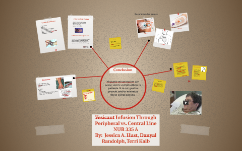 Vesicant Infusion through Peripheral vs. Central Line Infusi by Terri ...