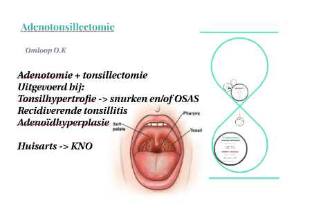 Adenotonsillectomie by Denise Lacle on Prezi