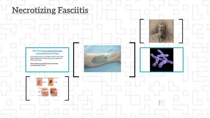 CDC Tracks Necrotizing Fasciitis Caused By Group A Strep By Megan cdc-tracks-necrotizing-fasciitis-caused-by-group-a-strep-by-megan