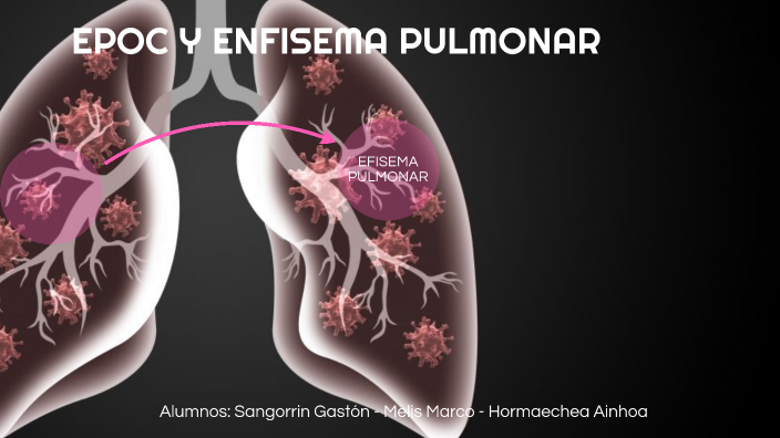 EPOC Y EFISEMA PULMONAR by Ainhoa Hormaechea on Prezi