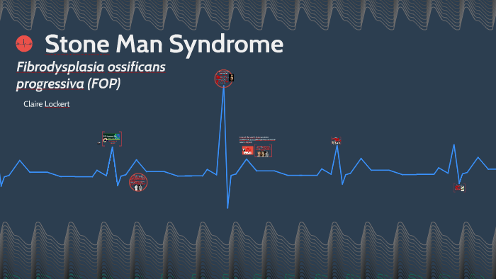 stone man syndrome