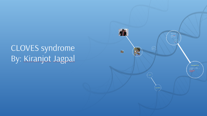 CLOVES Syndrome By Kiranjot Jagpal On Prezi