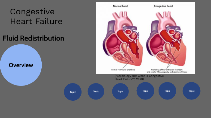 Fluid Redistribution by Valin Moore on Prezi