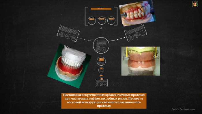 Постановка искусственных зубов по васильеву презентация