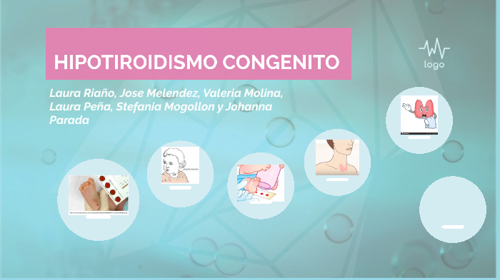 Hipotiroidismo Congenito By Laura Pena On Prezi