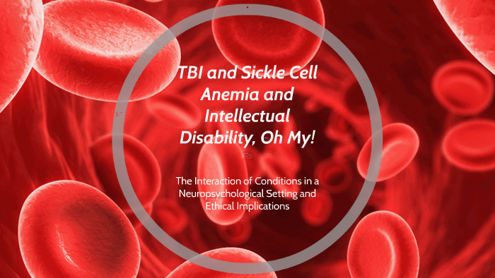 Tbi And Sickle Cell Anemia And Intellectual Disability Oh M By Jason Kisser On Prezi 9255