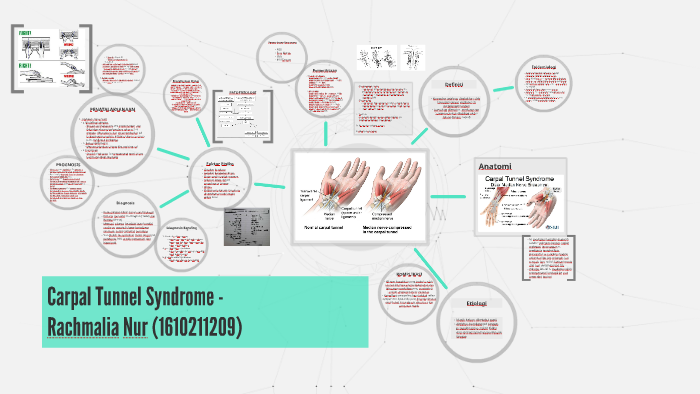 Carpal Tunnel Syndrome - By Rachmalia Nuragustin On Prezi