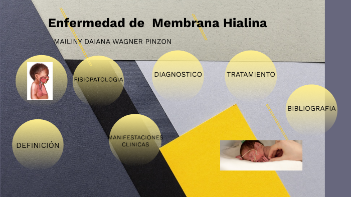 Enfermedad de Membrana Hialina by Mailiny wagner pinzon on Prezi