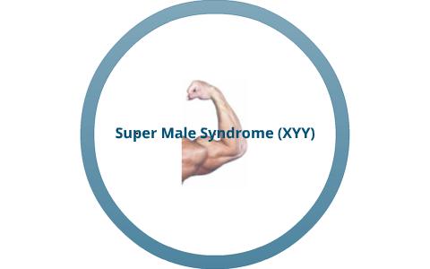 xyy super male syndrome