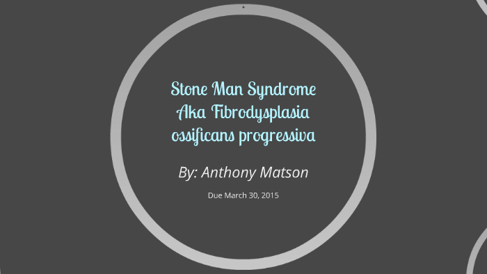 Stone Man Syndrome by Anthony Matson on Prezi