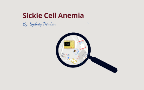 Sickle Cell Anemia by Sydney Yendys